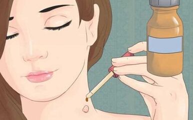 How to get rid of papillary therapy