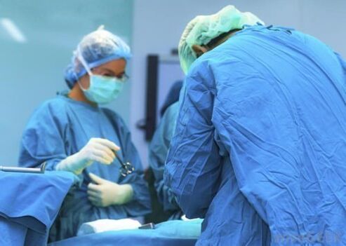 Surgery to remove papilloma