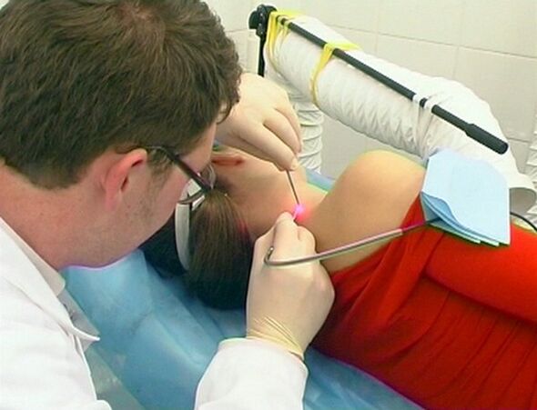 Remove papilloma