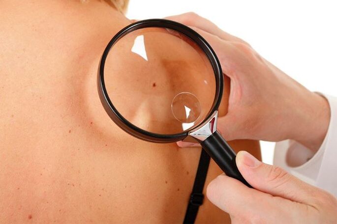Testing for HPV patients